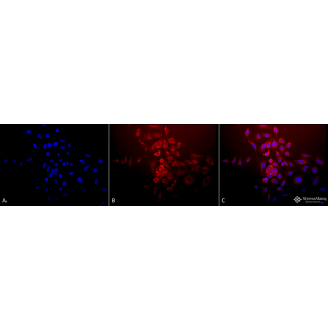 Western Blot