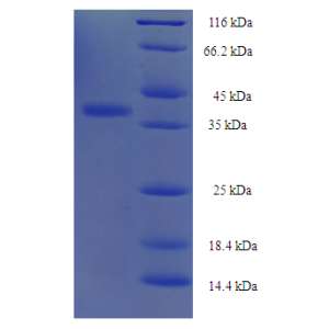 Protein SDS-PAGE