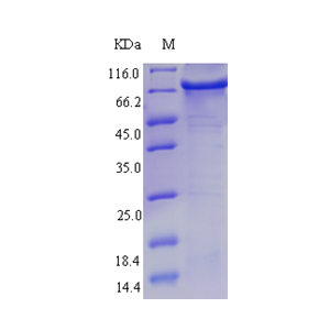 Protein SDS-PAGE