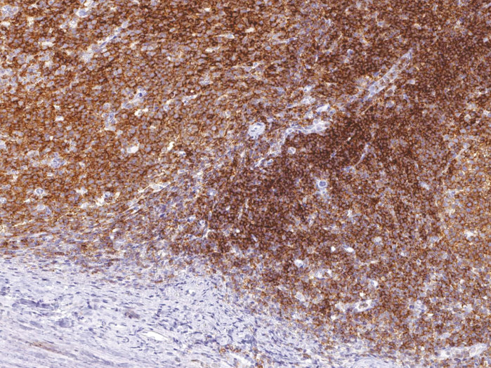 Antibody Anti-CD45 (PTPRC) (Hu) from Mouse (IHC045) - unconj.