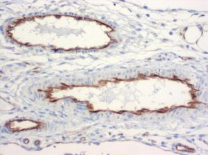The monoclonal antibody clone SZ31 (DIA-310) reacts specifically with endothelial cells in vessels and capillaries of mesenteric vessels from mice (FFPE tissue). Der monoklonale Antikörper Klon SZ31 (DIA-310) reagiert spezifisch mit Endothelzellen in Gefäßen und Kapillaren in mesenterialen Gefäße der Maus (FFPE Gewebe).