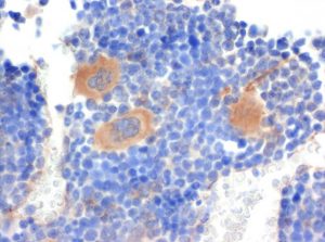 The monoclonal antibody clone SZ31 (DIA-310) reacts specifically with endothelial cells in vessels and capillaries of mouse bone marrow (FFPE tissue). Der monoklonale Antikörper Klon SZ31 (DIA-310) reagiert spezifisch mit Endothelzellen in Gefäßen und Kapillaren im Knochenmark der Maus (FFPE Gewebe).
