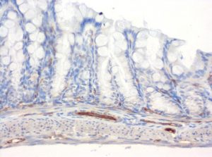 The monoclonal antibody clone SZ31 (DIA-310) reacts specifically with endothelial cells in vessels and capillaries of mouse colon (FFPE tissue). Der monoklonale Antikörper Klon SZ31 (DIA-310) reagiert spezifisch mit Endothelzellen in Gefäßen und Kapillaren des Dickdarm aus der Maus (FFPE Gewebe).