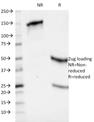 SDS-PAGE Analysis of Purified HLA-ABC Mouse Monoclonal Antibody (246-B8.E7). Confirmation of Integrity and Purity of Antibody.