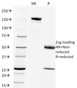 SDS-PAGE Analysis of Purified Rabies Virus Mouse Monoclonal Antibody (Rab-50). Confirmation of Purity and Integrity of Antibody.