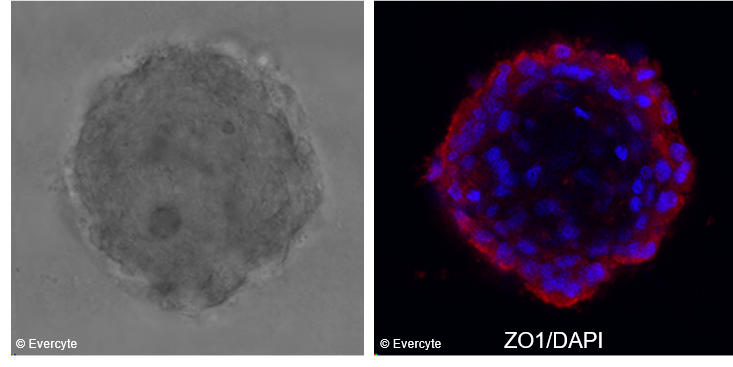HCEC-1CT Expression of ZO1 in 3D spheroid cultures