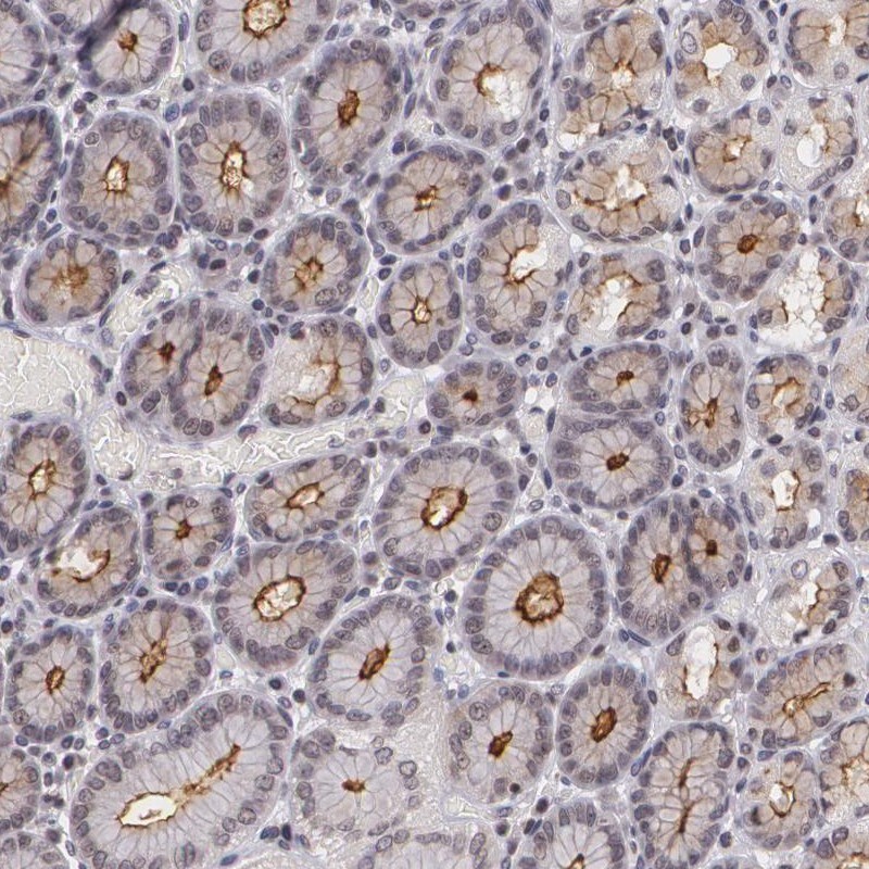 Figure 2 IHC staining of human stomach