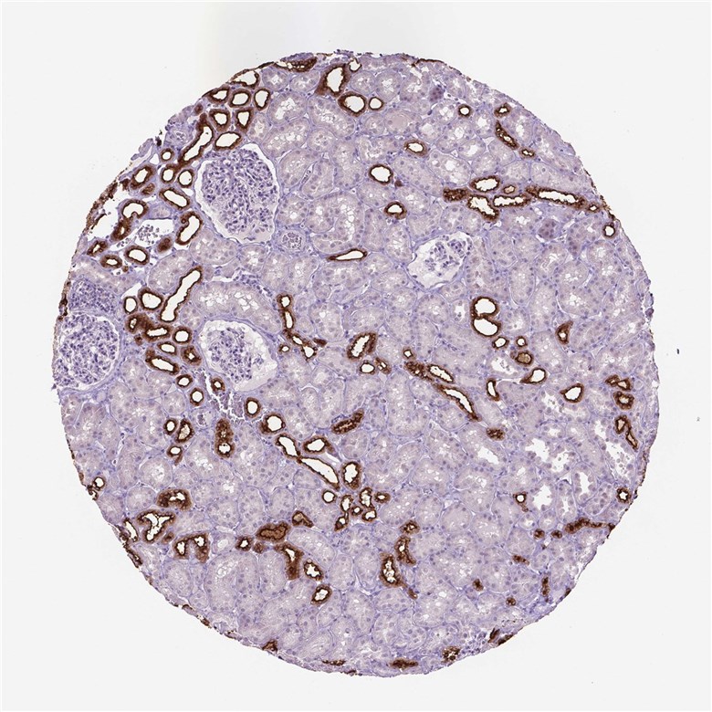 Figure 7 Kidney