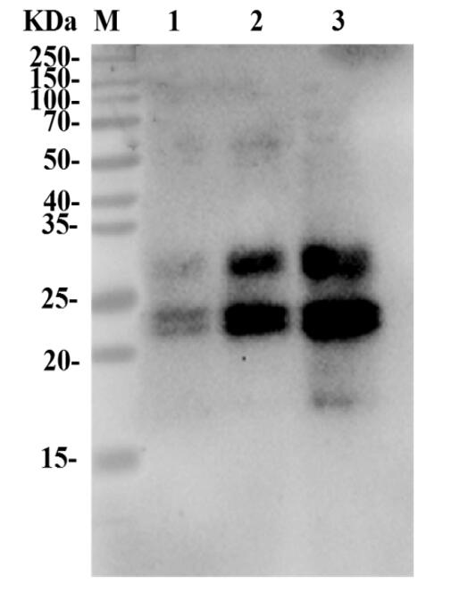 Figure 2 Anti-Human MUC1 Therapeutic Antibody (TAB-418MZ) in WB