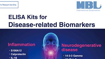 Brochure: ELISA Kits for Disease-related Biomarkers