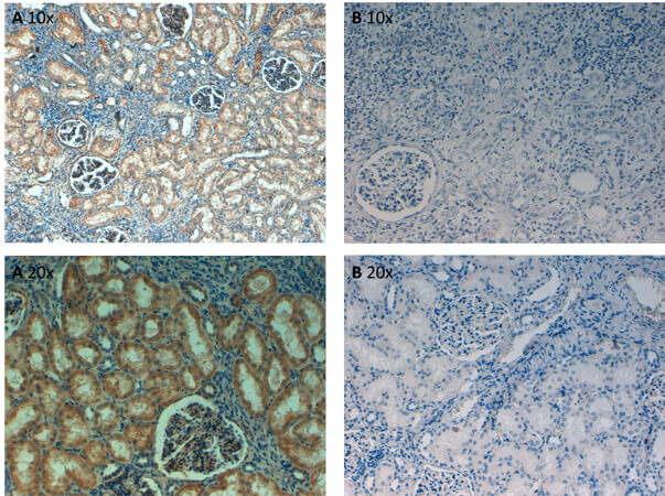 Immunohistochemistry - Anti-Fibronectin Antibody.