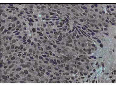 Immunohistochemistry - Jagged-1 Antibody