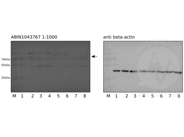 Western blot Anti-Jagged-1 (RABBIT) Antibody.