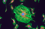 PDGFRB probe for ISH CE/IVD - Chronic myeloid leukemia (CML)