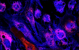 TERT-Sonde für FISH CE/IVD - Gehirn und neuronale Pathologie