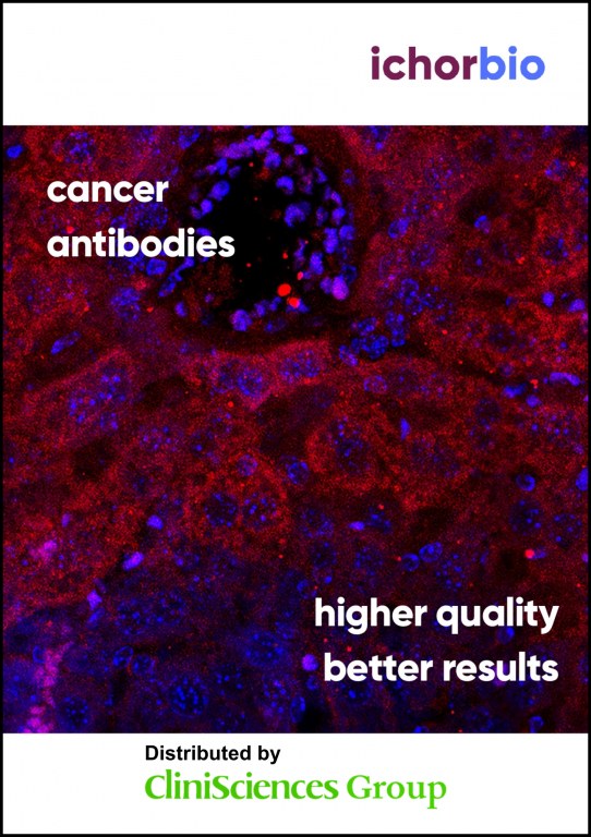 /upload/cancer-antibodies-ss2hkj.jpg