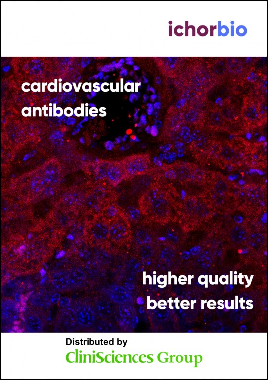 /upload/cardiovascular-antibodies-pkcmnw.jpg