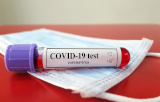COVID-19 - Serological tests