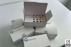 LymphoSign: CE/IVD-Kit zur Klassifizierung von Non-Hodgkin-Lymphomen