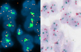 In-situ-Hybridisierung