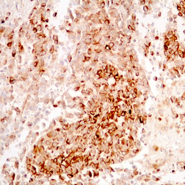 Anti Nestin Ce Ivd For Ihc Dermopathology Biotrend