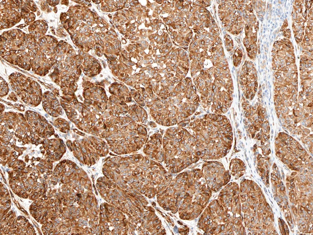 Anti Nestin Ce Ivd For Ihc Dermopathology Biotrend