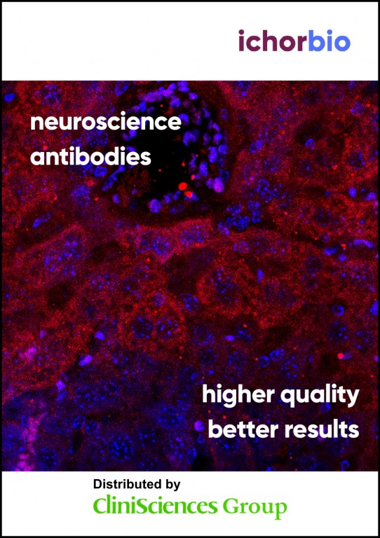 /upload/neuroscience-antibodies-s8ngje.jpg