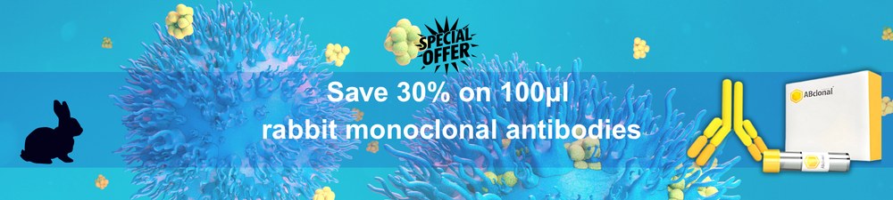 /upload/promotion-2-gdmntp.jpg