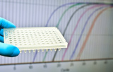Quantitative PCR in Echtzeit für die Diagnose