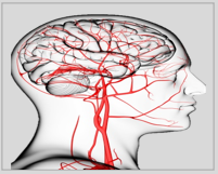 stroke