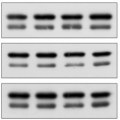 Custom service : Antibody validation in WB