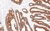 Cytokeratin 19