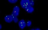 Molecular cytogenetics