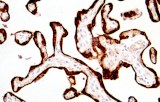 hPL