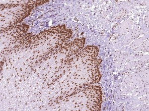 New antibodies for diagnostic = free samples