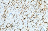 Myelin (MBP)
