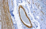 Myosin der glatten Muskulatur