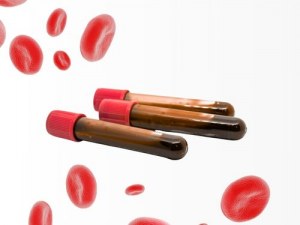 Von Vollblut bis zu PBMCs: Ihr komplettes Portfolio an Blutproben