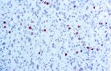 Phosphohiston 3 (PHH3)
